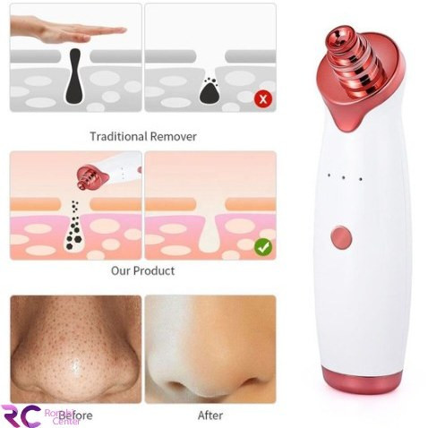 دستگاه میکرودرم خانگی شارژی مدل M-14