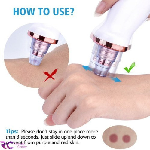 دستگاه میکرودرم خانگی شارژی مدل M-14